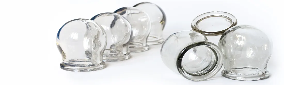 Cupping therapy